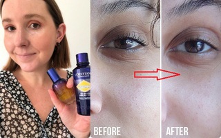 Theo các bác sĩ da liễu thì đây là 5 lọ toner có khả năng "là phẳng", làm đầy mọi nếp nhăn lão hóa của các chị em