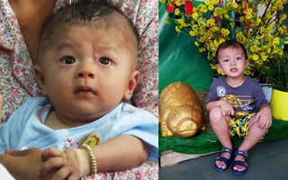 Bé trai Vĩnh Long bị đâm xuyên não lúc mới sinh đón giao thừa cùng mẹ trong viện, ngổn ngang nỗi lo sau Tết