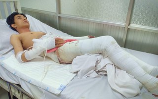 Đi làm lò heo kiếm tiền lo cho cha mẹ và em gái, chàng trai 25 tuổi ngã vào nồi nước sôi bỏng nặng
