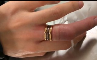 Cô gái đau khổ vì phải cắt chiếc nhẫn kỷ niệm do tăng cân, nhưng cách xử lý của bạn trai mới khiến mọi người chú ý
