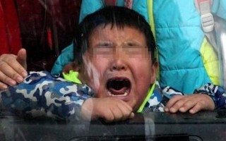 Bạn chọc con trai 4 tuổi bị câm, mẹ đưa đến bệnh viện thì phát hiện bất thường trên lưỡi, nhưng bác sĩ lại chỉ ra nguyên nhân khác