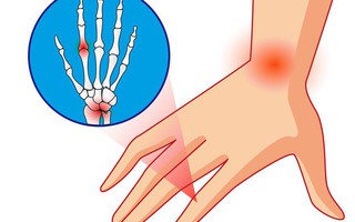 Dấu hiệu cảnh báo sớm có thể giúp bạn kịp thời xác định 10 bệnh nghiêm trọng
