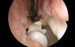Những ca bệnh hi hữu tưởng chừng chỉ có trong phim viễn tưởng nhưng lại “lộ diện” khiến mọi người bàng hoàng