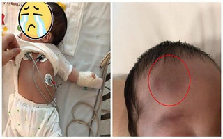 Con trai bị ngã từ cầu thang xuống mà không khóc, bà mẹ vô tư không cho con đi kiểm tra để rồi nhận kết quả gây sốc
