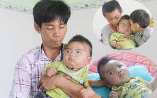 Cái Tết đầu tiên của bé Trọng Em 9 tháng tuổi bị mẹ bỏ rơi khi phát hiện bé bị bại não