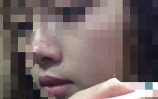 Nữ sinh bị sàm sỡ trong thang máy muốn “yêu râu xanh” xin lỗi công khai
