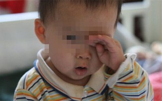 Con trai 2 tuổi bị sưng đỏ mắt, bố đưa đi khám liền kinh hãi tột độ khi bác sĩ lôi ra "dị vật" vẫn còn động đậy ở trong mắt bé