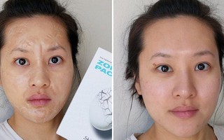 6 mặt nạ lạ tai nhưng lại trị mụn, dưỡng da cực đỉnh, thú vị nhất là loại zombie khiến bạn xấu xí trước khi đẹp lên