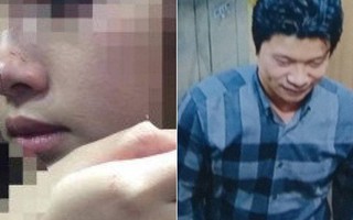 Nữ sinh bị cưỡng hôn trong thang máy: "Tôi thấy thất vọng, phạt 200.000 đồng quá nhẹ nhàng"