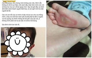 Mạng sống của con “ngàn cân treo sợi tóc” vì các mẹ nhất mực tin tưởng google hơn tin bác sĩ