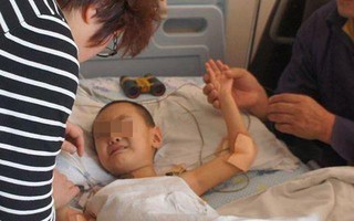 Đứa trẻ mới 3 tuổi đã bị sỏi dạ dày và thiếu máu nghiêm trọng, bác sĩ hỏi ra mới biết "hung thủ" âm thầm bấy lâu nay chính là một món đứa trẻ nào cũng thích
