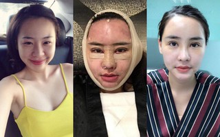 Gặp Ngọc Ly: Cô nàng đánh đổi gần 1 tỷ cùng 8 tiếng nằm trên bàn mổ để có được nhan sắc xinh đẹp 