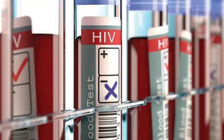 Xuất hiện bệnh nhân thứ 3 trên thế giới được chữa khỏi HIV