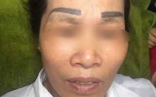 Xăm sai một li đi tận lên trán, người phụ nữ nhận về cặp lông mày "tân dòng sông ly biệt" hệt trò đùa