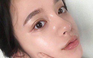 5 serum vô địch về khoản làm sáng da, trị thâm nám cứ đến hè lại được các tín đồ làm đẹp thi nhau khuân về