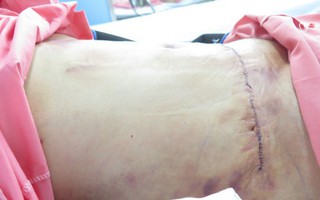 Hà Nội: Xôn xao thông tin cô gái trẻ tử vong khi đi hút mỡ bụng