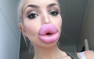 Thấy cũng tội nhưng thôi cũng kệ trước những thảm họa tiêm môi theo phong cách cá dọn bể