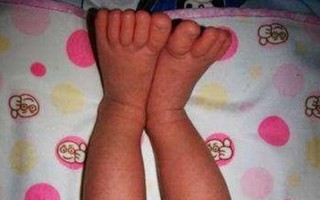 Trẻ con có những đặc điểm này thì xác định lớn lên sẽ có chiều cao lý tưởng khiến ai cũng phải ngước nhìn, hãy xem con bạn có không?