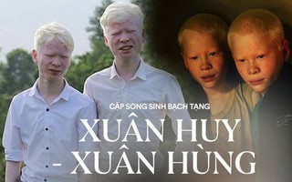 Hai anh em bạch tạng ở Hà Tĩnh từng gây cảm xúc trong bộ ảnh "Twins" vào 6 năm trước giờ ra sao?