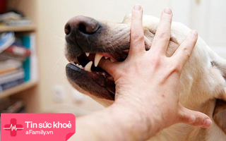 Cảnh báo: Liên tiếp nhiều trường hợp trẻ bị chó nhà nuôi hung hãn tấn công