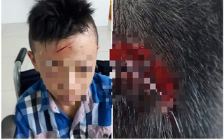 Vĩnh Long: Xác minh thông tin nam sinh lớp 7 bị bạn đánh chảy máu đầu, ngất xỉu 2 lần nhưng nhà trường không đưa đi cấp cứu
