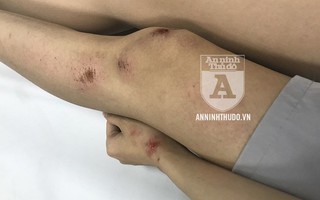 [CLIP] Sự manh động khó tin của đối tượng bệnh hoạn gây tai nạn để xâm hại các cô gái trẻ