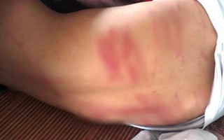 Lời khai ban đầu của người bố đánh con trai bầm tím, ngất xỉu trên lớp: Dùng roi đánh hơn 30 phút vì nghĩ con chơi game
