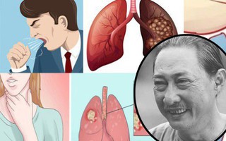 Chỉ sau 1 năm chống chọi với ung thư phổi, nghệ sĩ Lê Bình qua đời: Đừng bỏ qua các dấu hiệu cảnh báo bệnh sớm