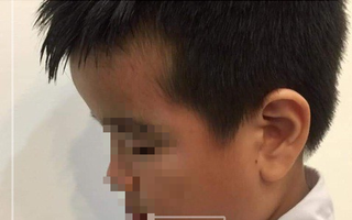 Hiệu trưởng lên tiếng vụ giáo viên tát học sinh bầm mặt trong giờ kiểm tra: Cần có hình thức kỷ luật cao hơn với cô giáo