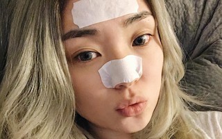 Dùng miếng dán lột mụn thì nhìn đã mắt thật, nhưng liệu có tốt cho da?