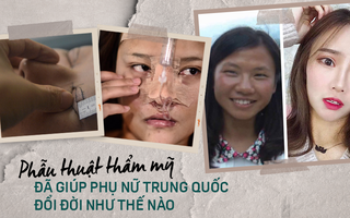 Những cô gái "đập mặt xây lại" ở Trung Quốc: Đời sang trang nhờ diện mạo mới đến nỗi xem bác sĩ thẩm mỹ là cha mẹ thứ 2