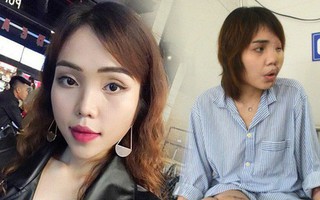 Nỗi đau tột cùng của cô gái bị chồng sắp cưới tạt axit biến dạng gương mặt: "Đêm tôi không dám ngủ vì giây phút ấy lại hiện về"