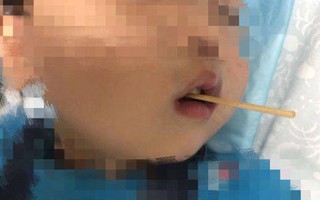 Cậu bé 3 tuổi suýt mất mạng sau khi ăn xúc xích, cha mẹ vạn lần không được cho con vừa ăn vừa làm điều này