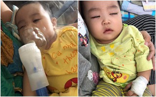 Sau chuỗi ngày kinh khủng từ lúc con ho nhẹ, suy hô hấp đưa đi chụp X-quang trắng xóa, người mẹ trẻ lên tiếng cảnh báo nghiêm cấm người lớn làm điều này