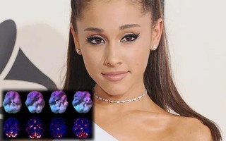 Nữ ca sĩ Ariana Grande chia sẻ bức ảnh "đáng sợ" về "căn bệnh" đã hủy hoại bộ não của cô