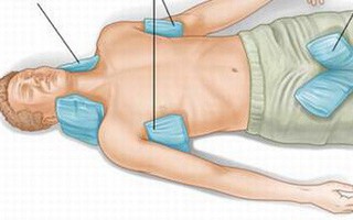Từ trường hợp nghi tử vong do sốc nhiệt: Cần phòng và sơ cứu đúng cách