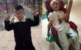 Bé trai 6 tuổi bị mẹ kế bạo hành đến tổn thương 75% não phải sống đời thực vật, bố ruột biết chuyện bỏ trốn mất dạng