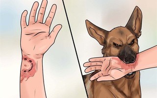 Cả nước có 16 người tử vong trong 4 tháng đầu năm vì bệnh dại: Cảnh báo bệnh dại có chiều hướng gia tăng