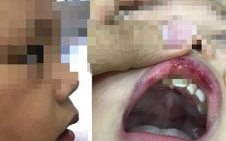 Lá thư xin lỗi gửi lúc đêm muộn của cô giáo ở Hà Nội tát bé hơn 2 tuổi sấp mặt