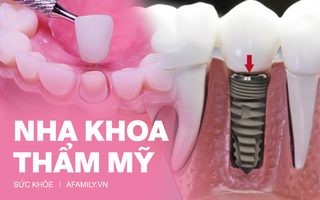 Bọc răng sứ: Đây là quy trình đầy đủ dành cho những ai muốn biết rõ phải tiến hành như thế nào