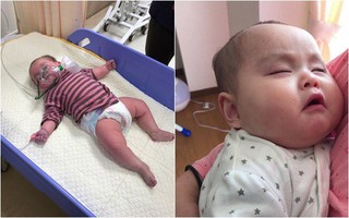 Bé 6,5 tháng ăn trứng bị dị ứng tím tái cả người - cha mẹ hết sức cẩn trọng khi cho con thử món mới ăn dặm 