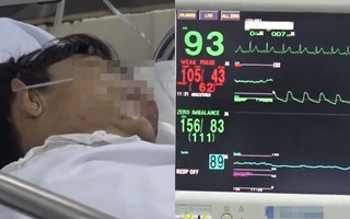 Lời kể hãi hùng của người đàn ông bị hổ vồ đứt lìa 2 cánh tay ở Bình Dương