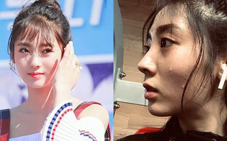 “Tình đầu quốc dân” Hình Phi cũng từng khổ sở vì mụn bởi sai lầm từ bước chăm da đầu tiên mà nhiều người mắc phải