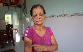 Con dâu mới sinh đánh mẹ chồng 65 tuổi sưng tím mặt rồi lại ngồi xuống khóc lóc xin lỗi, mong mẹ "đừng nói với ai"