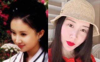 Thư Sướng lộ di chứng phẫu thuật thẩm mỹ: Tiếc cho mỹ nhân một thời!