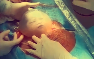Đốn tim với khoảnh khắc em bé chào đời trong bọc ối, chớp mắt mỉm cười