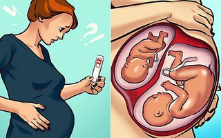 Khoa học xác nhận: Đang mang thai vẫn có thể dính bầu, chuyện tưởng hoang đường nhưng hoàn toàn có thật