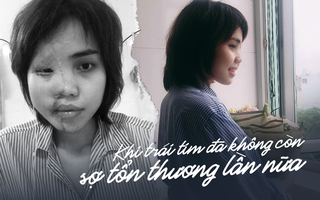 Cô gái bị chồng sắp cưới tạt axit trong ngày kẻ ác đền tội: "Từ lâu tôi đã không còn quan tâm đến người đàn ông ấy"