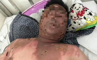 Hỏi tuổi bố bạn nhậu, bị hất cả nồi lẩu vào mặt