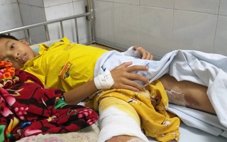 Nồi áp suất nổ tung gây bỏng, mẹ đưa 2 con đi chữa thầy lang thì hoại tử nặng, nguy cơ mất bộ phận sinh dục